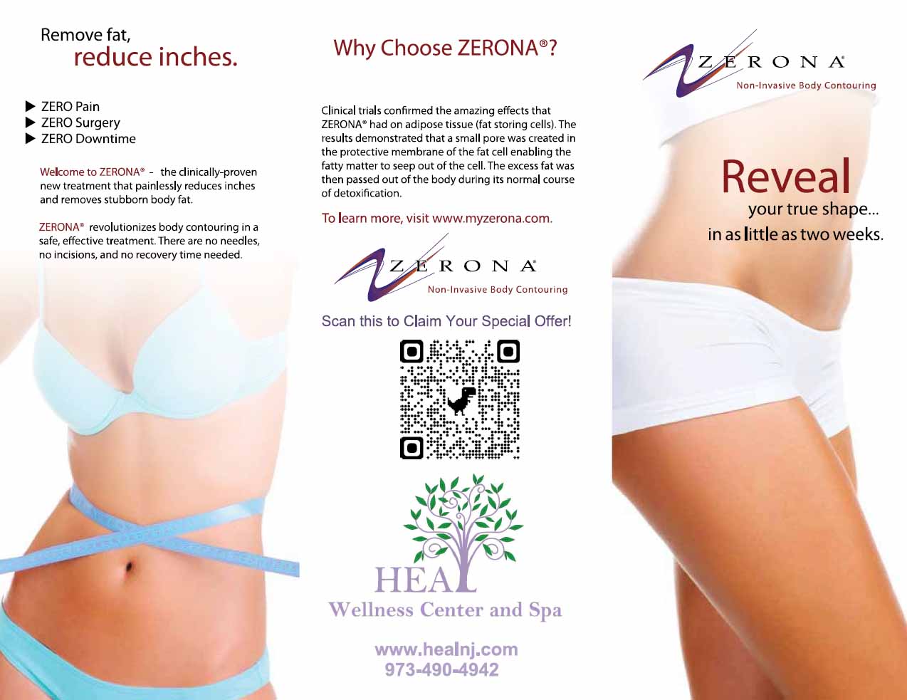 Zerona - Z6 Laser, Body Contourong, Laser Slimming Program